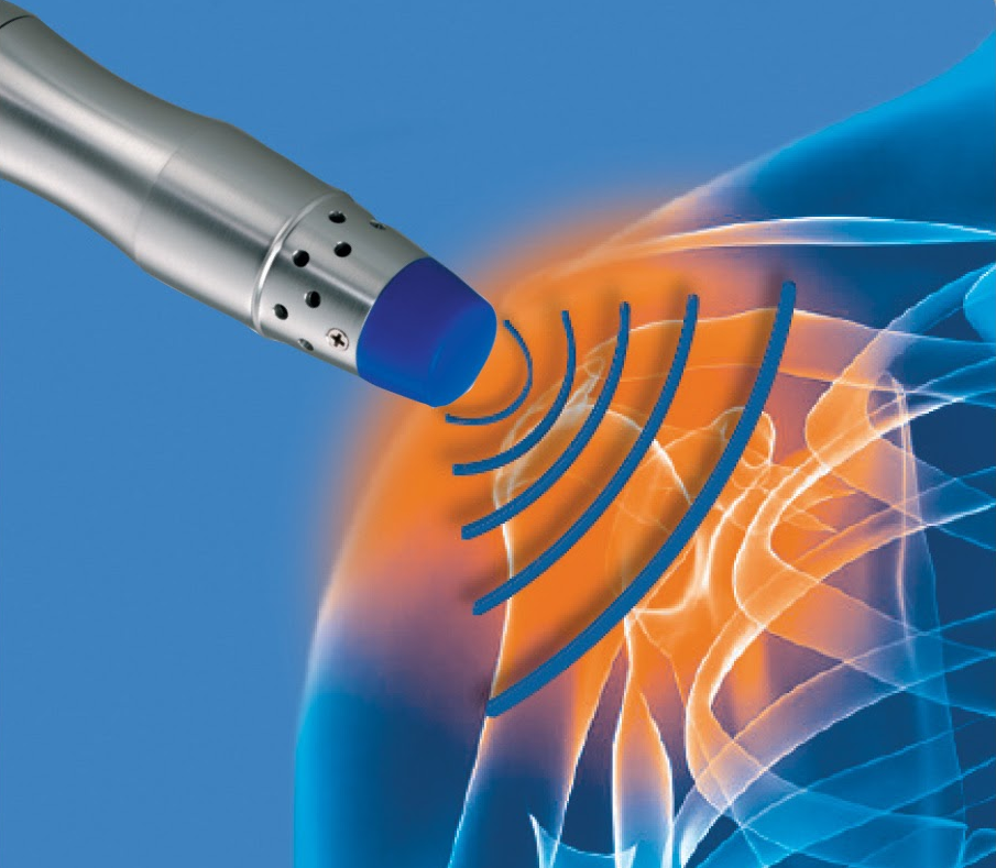 shockwave therapy